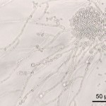 Is Candida Infection Affecting Your Health?