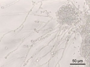 candida-albicans candida-ablicans